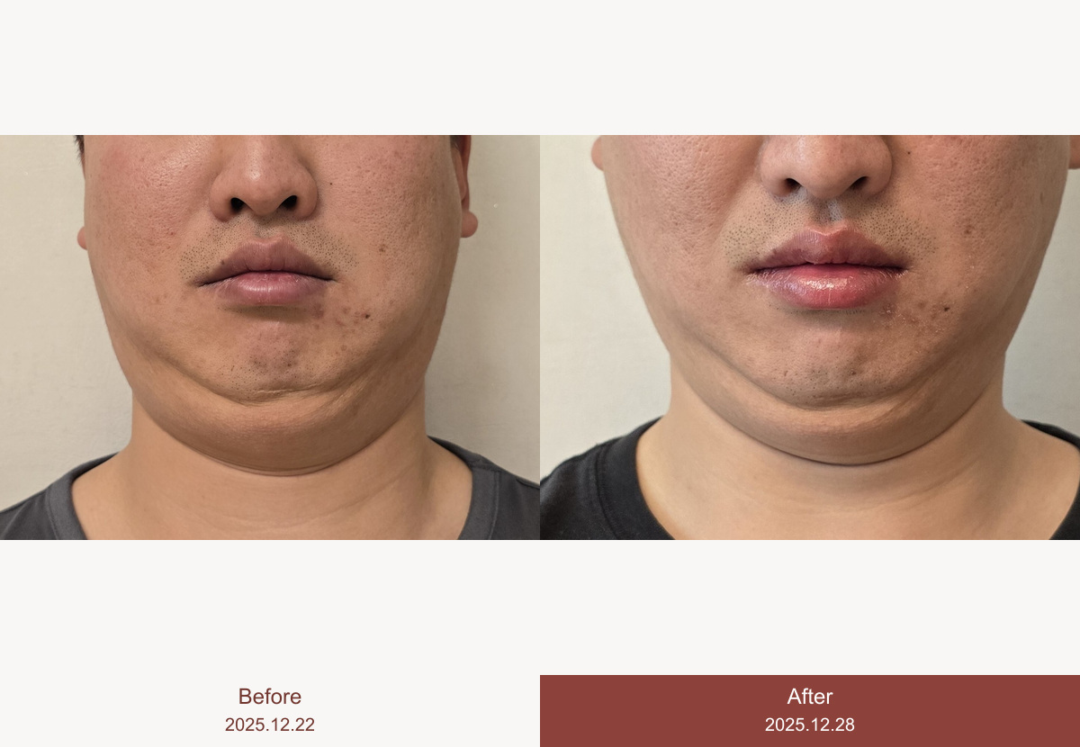 윤곽반쪽샷