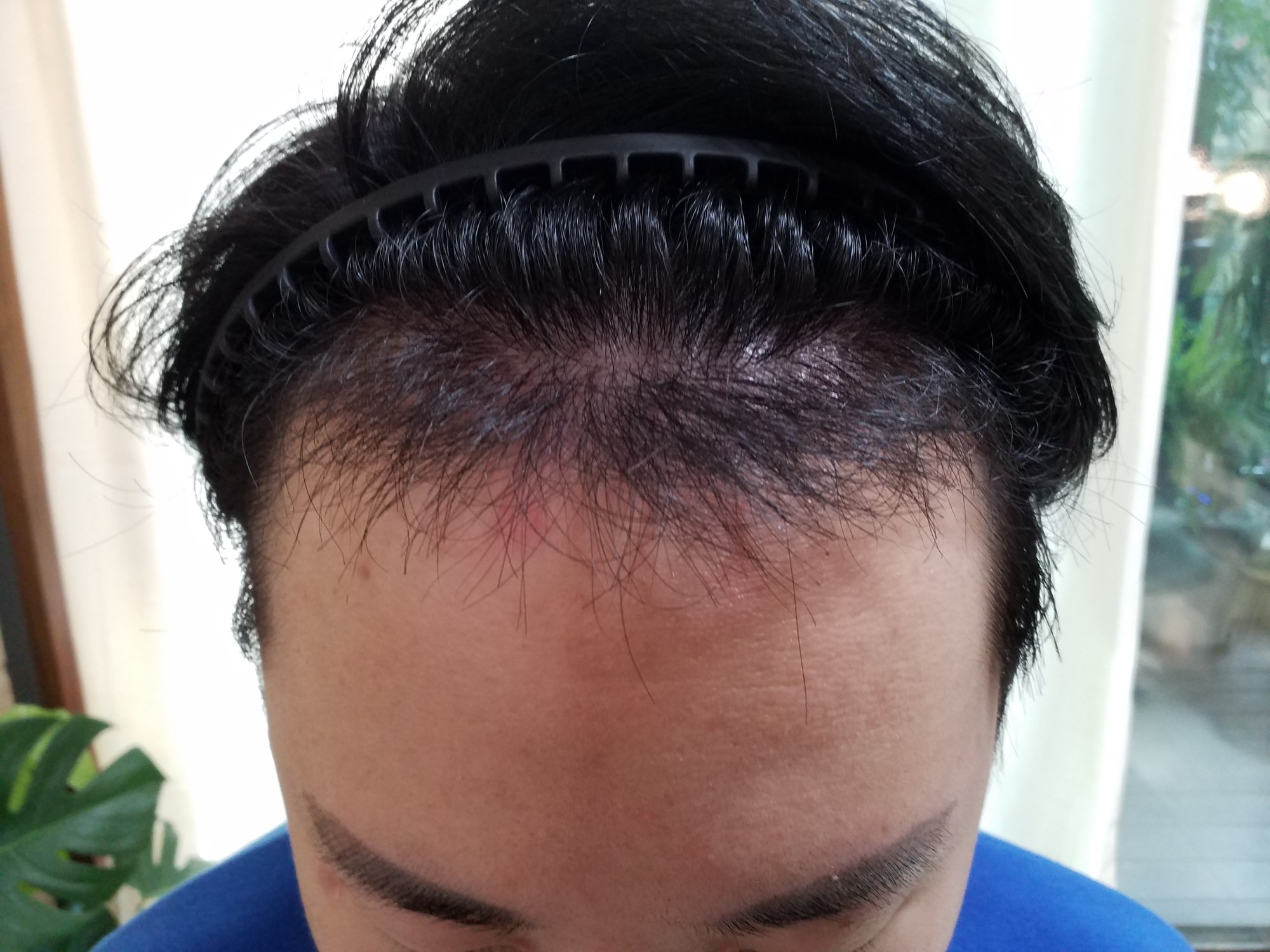 경과