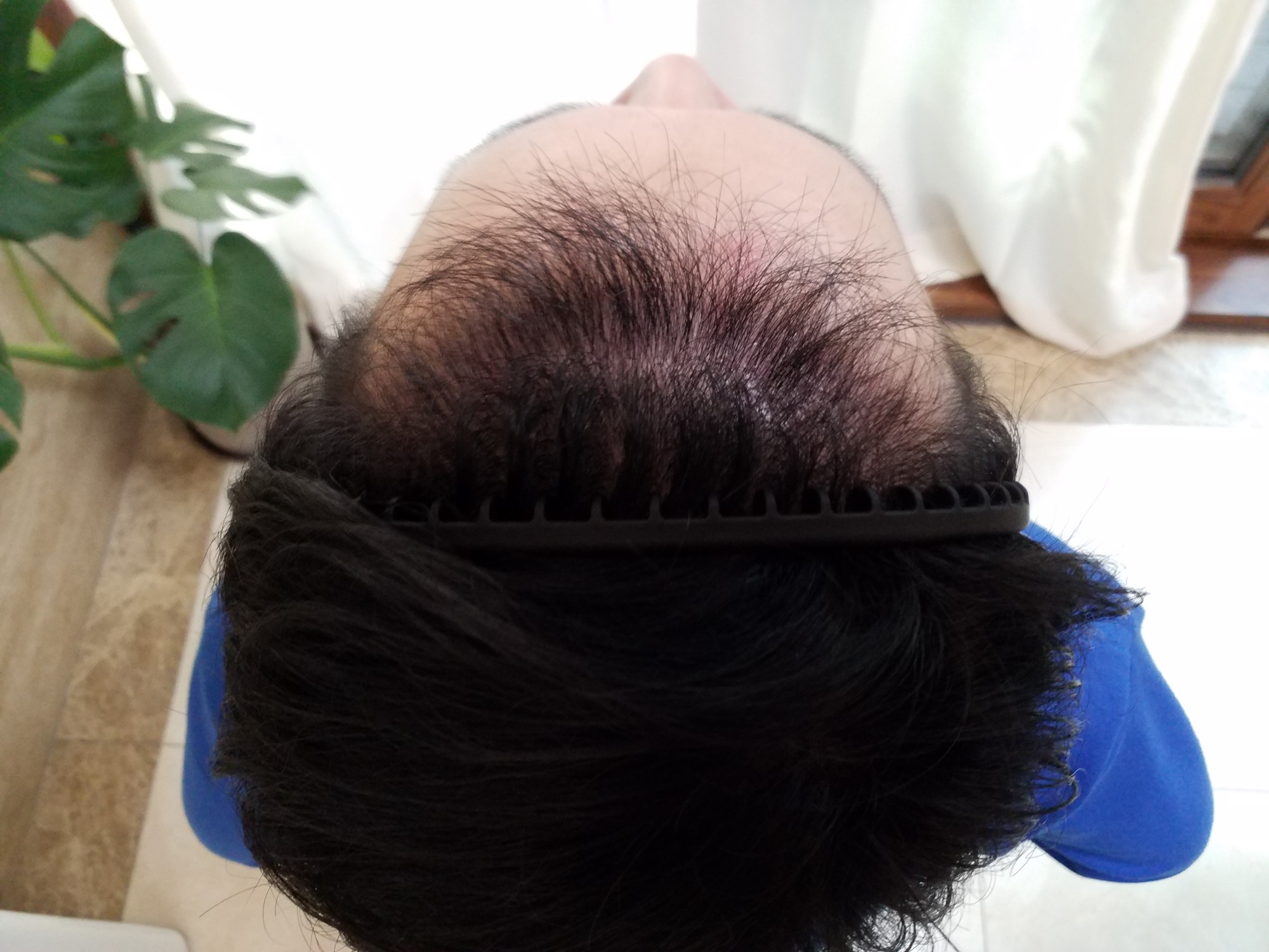 7개월 경과