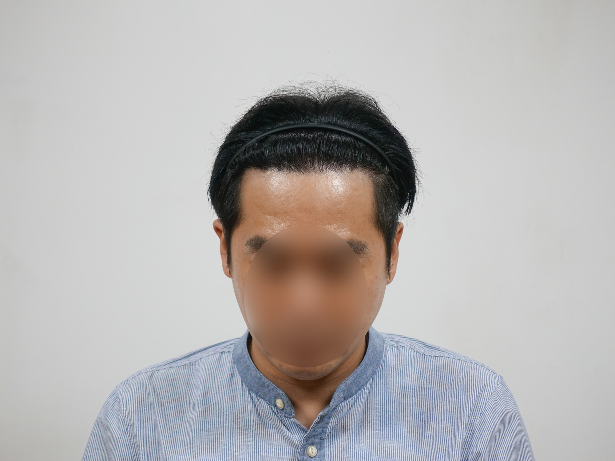 최종 경과