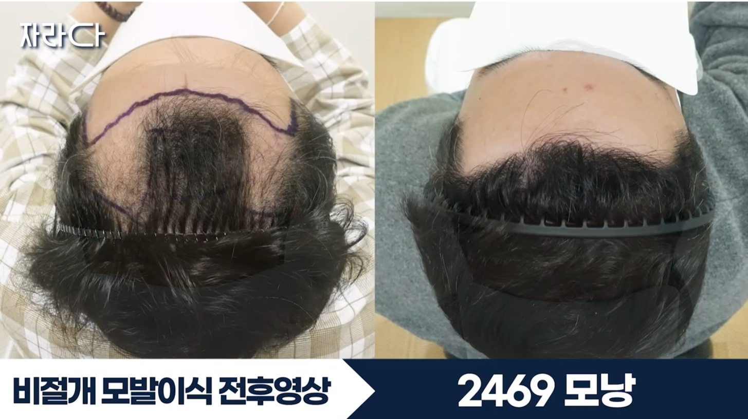 수술 전후