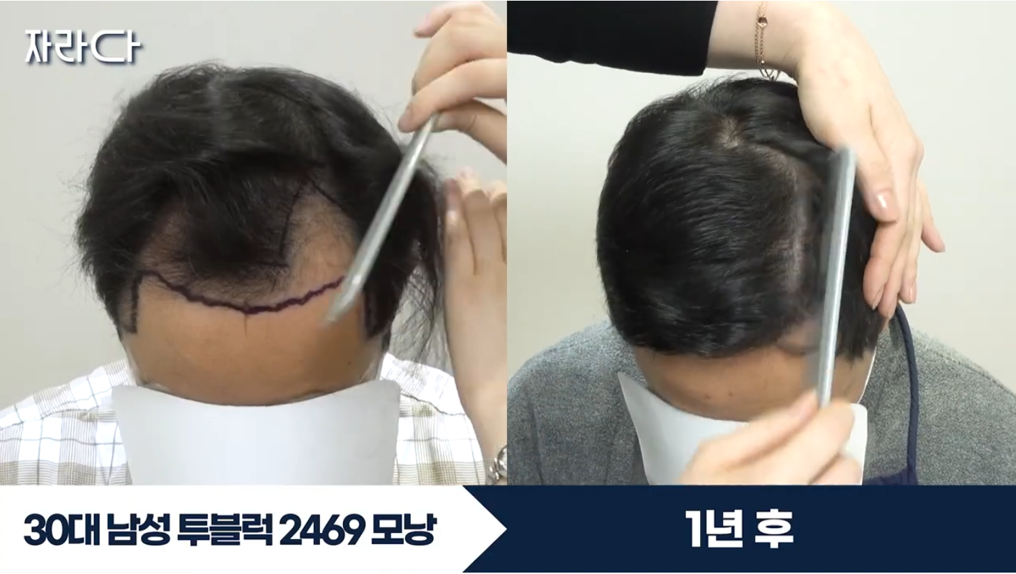 수술 전후