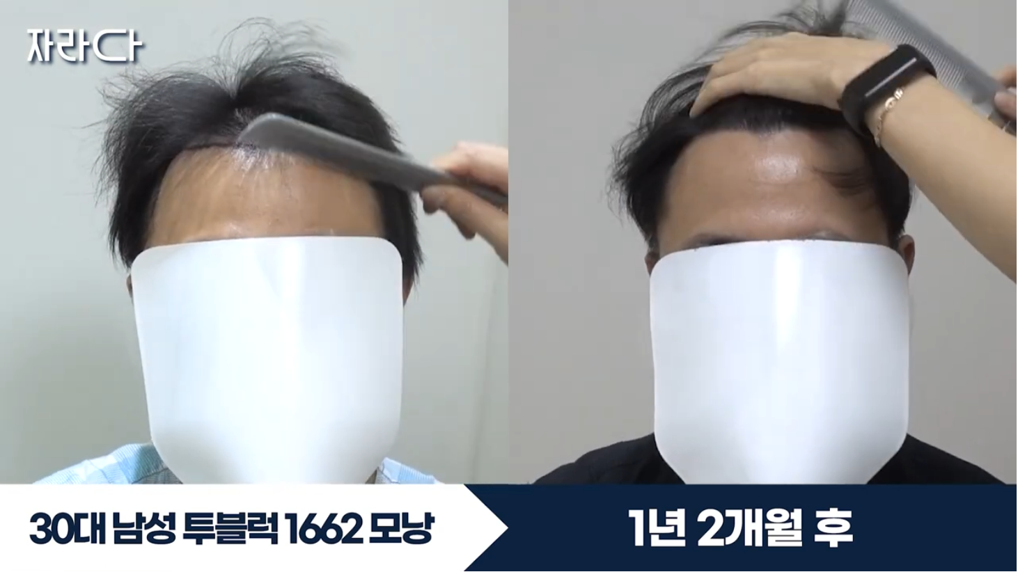 수술 전후