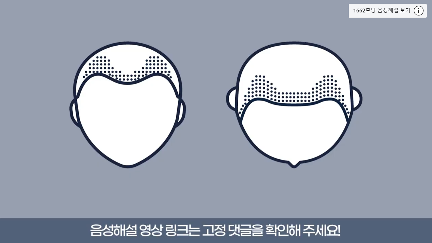 수술 전후