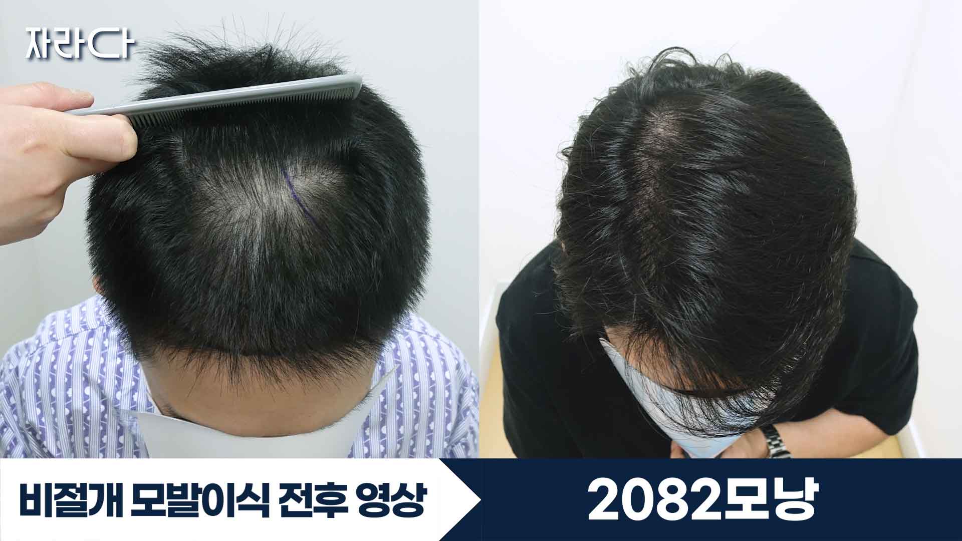수술 전후