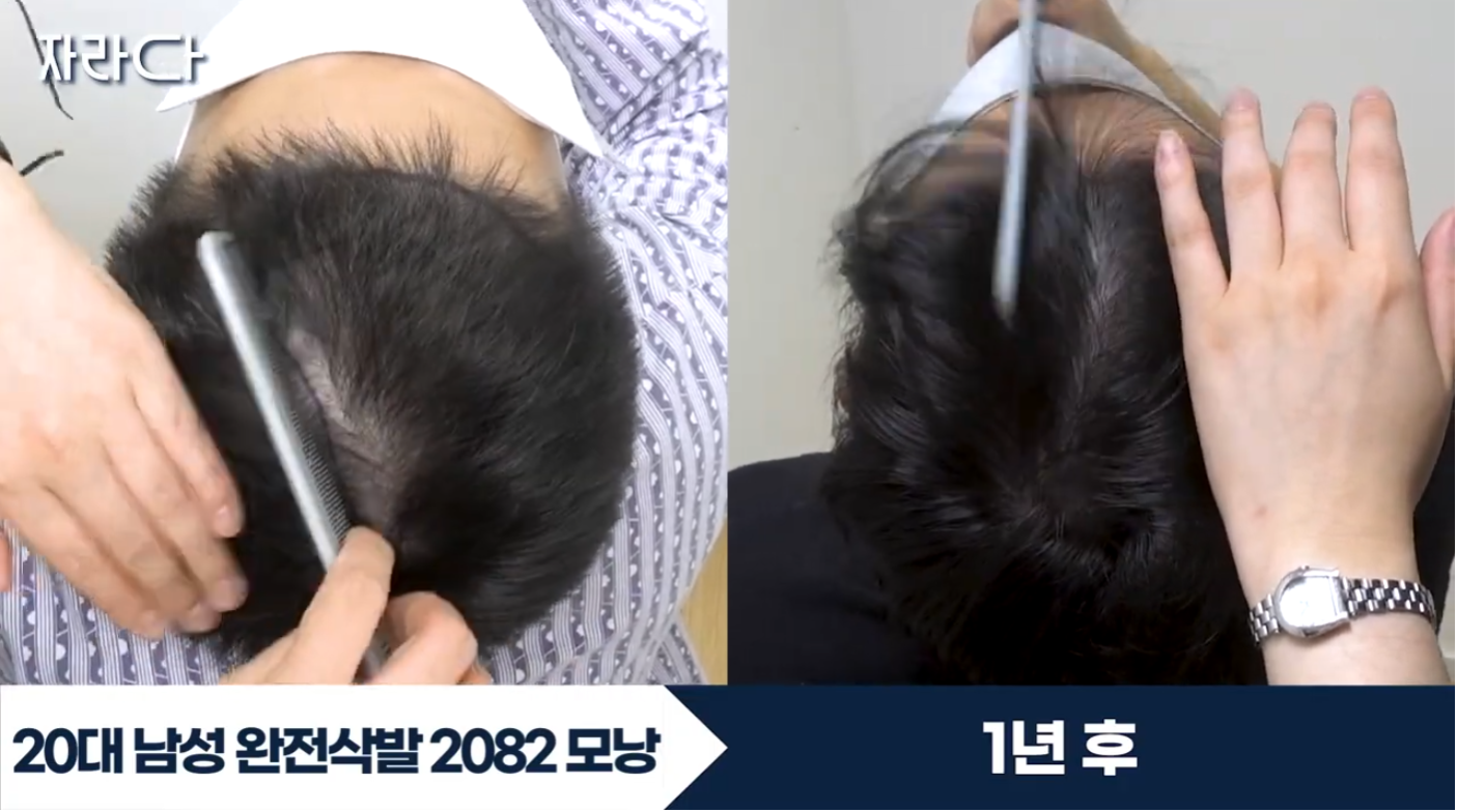 수술 전후
