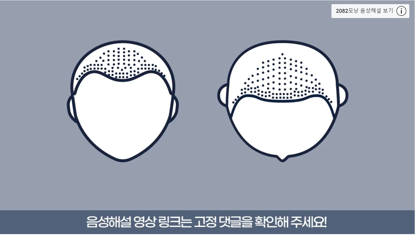 수술 전후