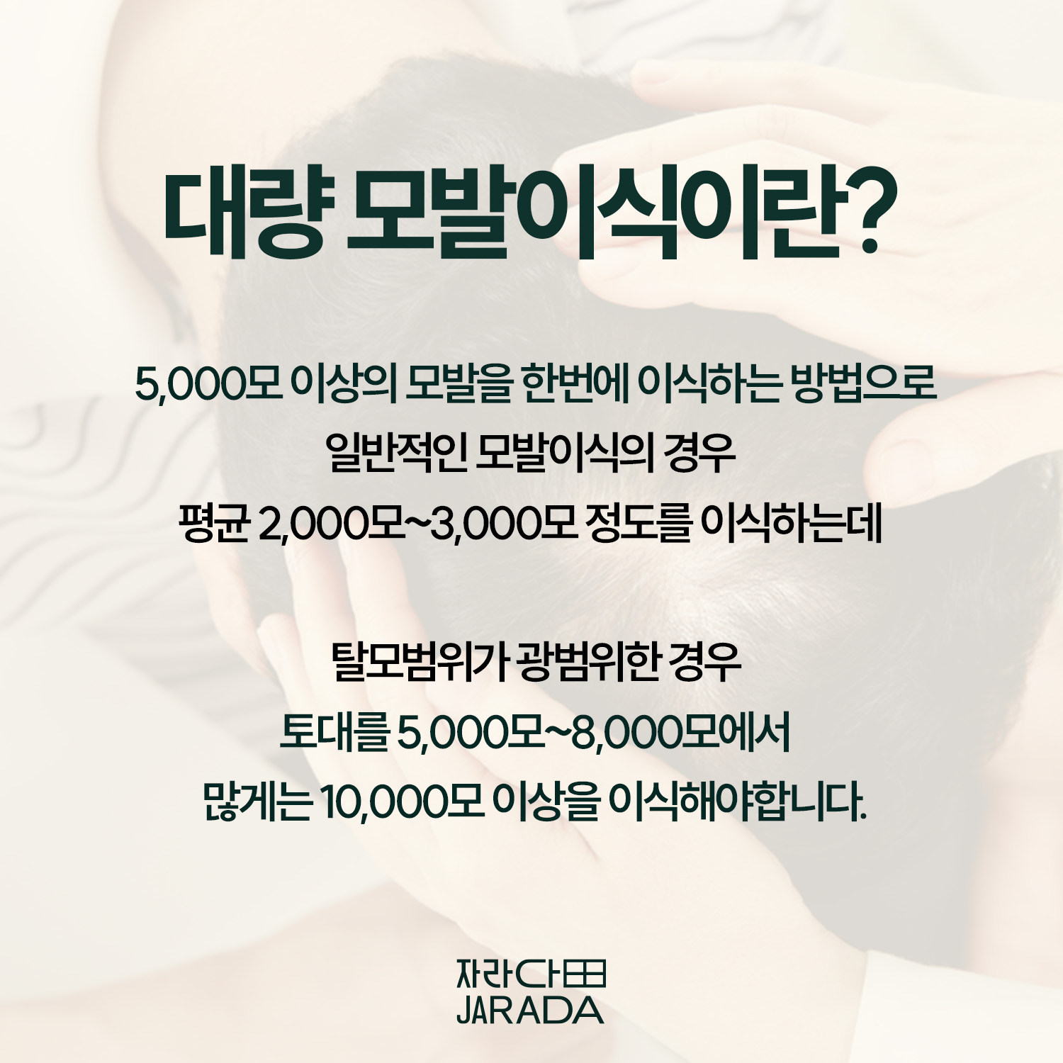 대량 모발이식이란