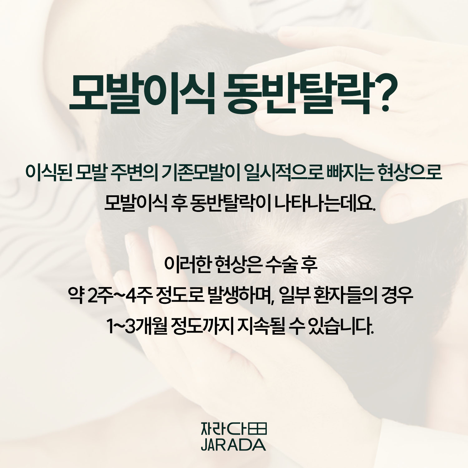 모발이식 동반 탈락