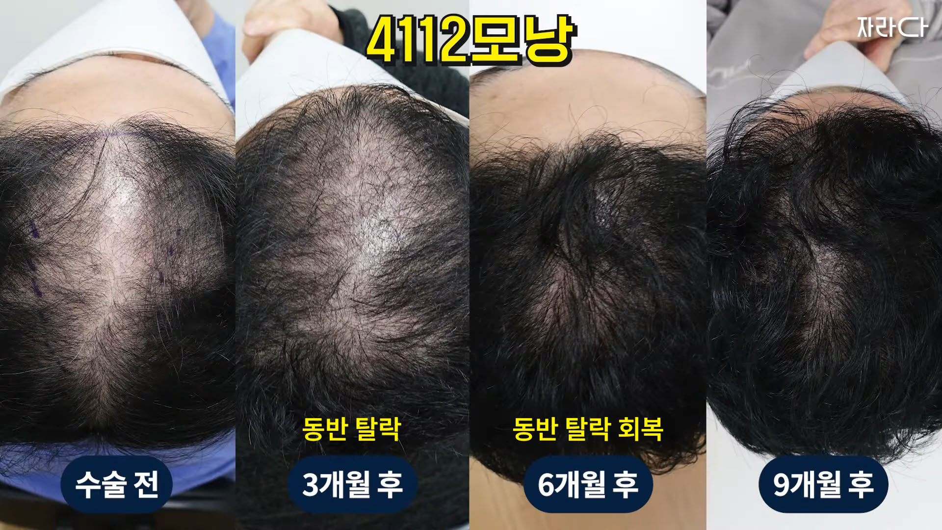 3개월부터 9개월까지 경과