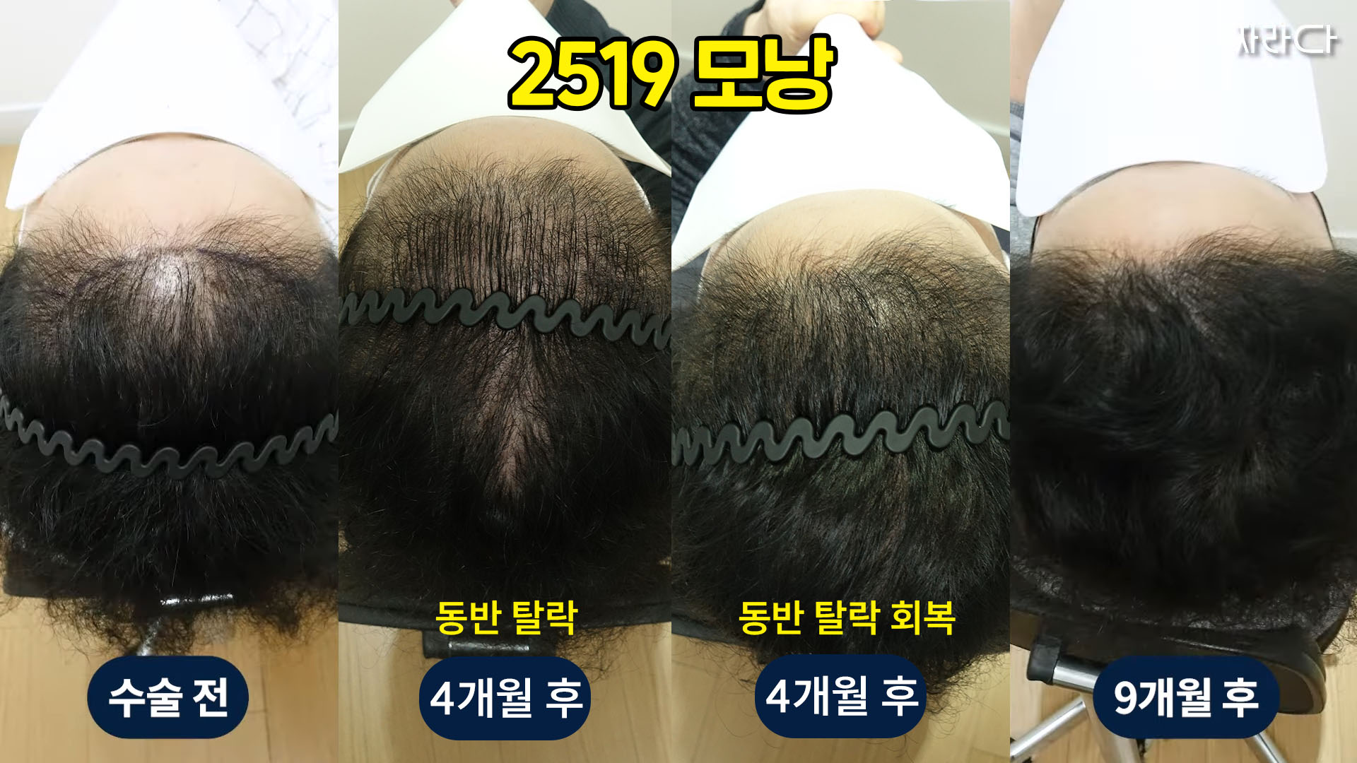 회복 경과
