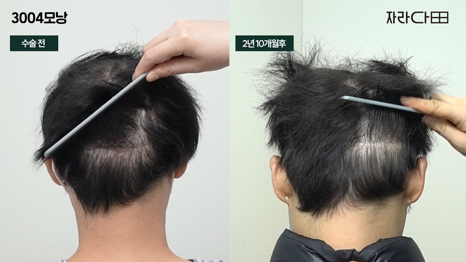 후두부 상태 확인