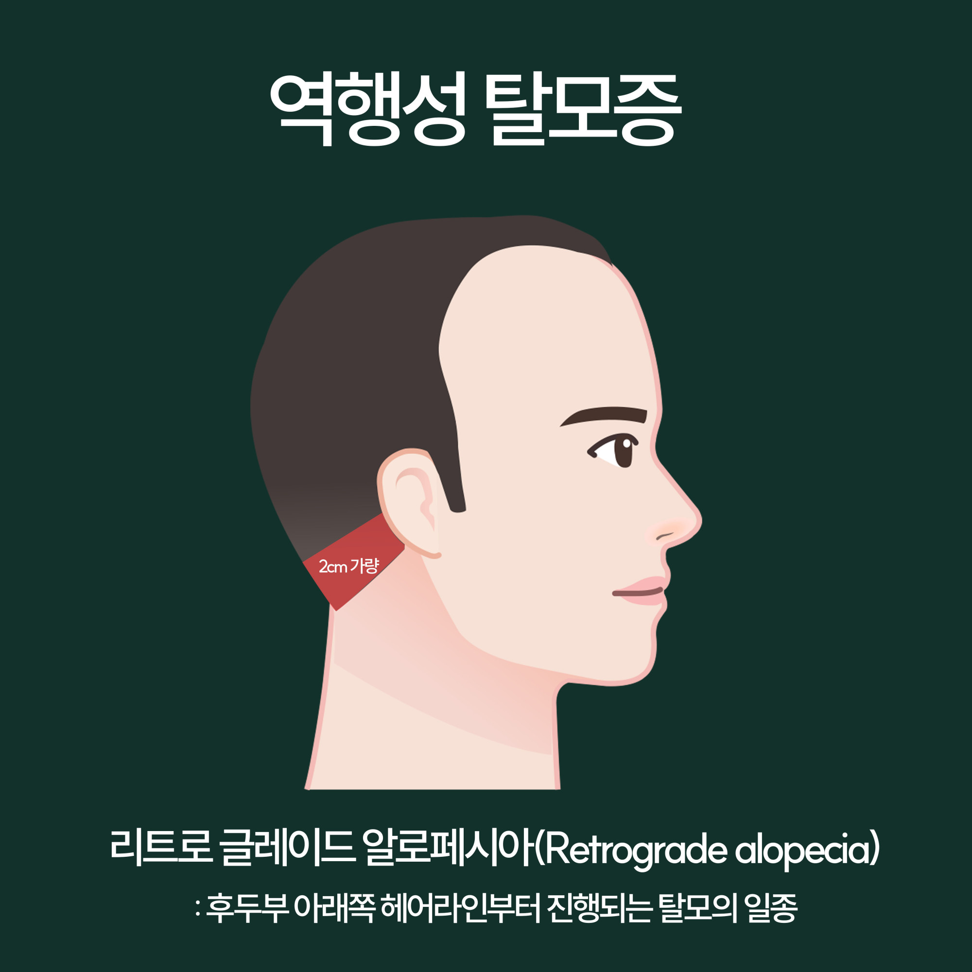 경과