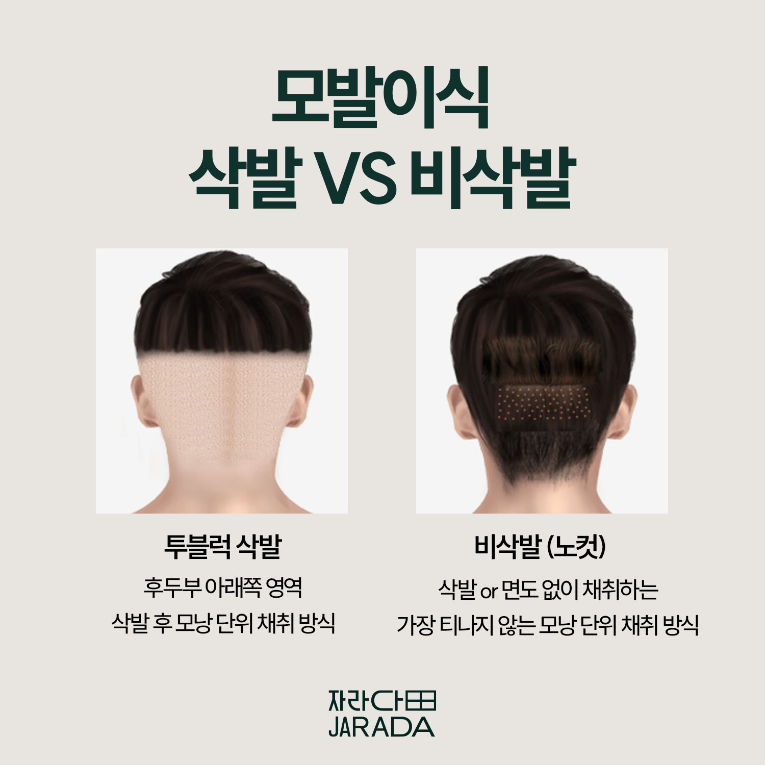 삭발과 비삭발