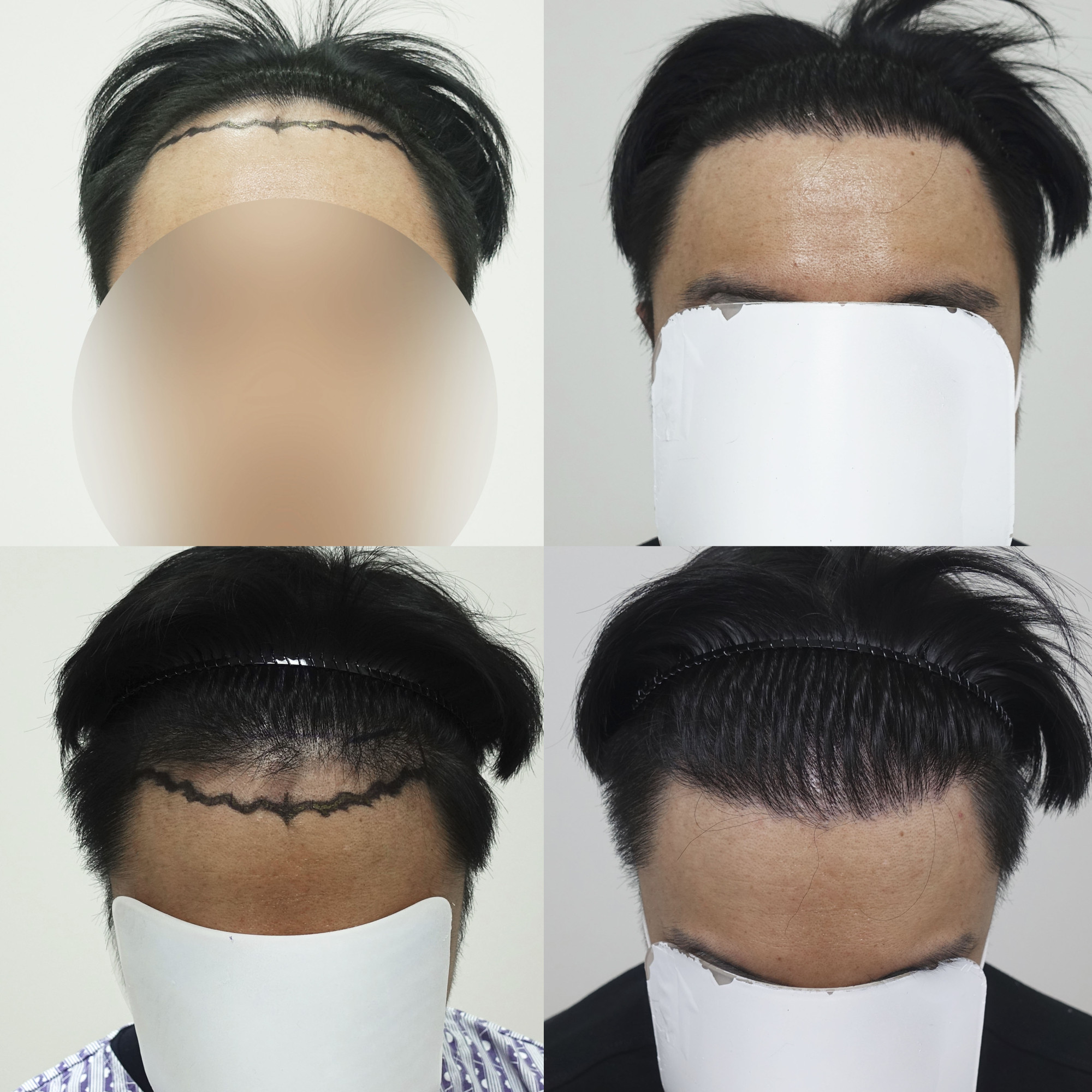 전 각도 확인