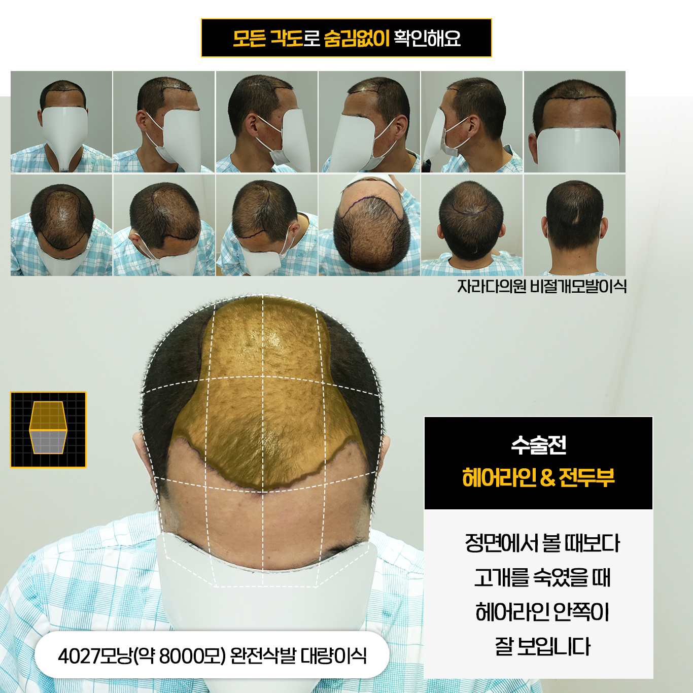 모든 각도로 확인
