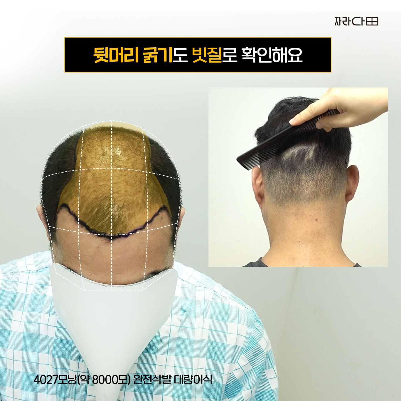 뒷머리 굵기 확인