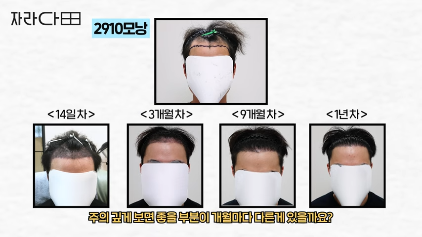 1년까지의 경과