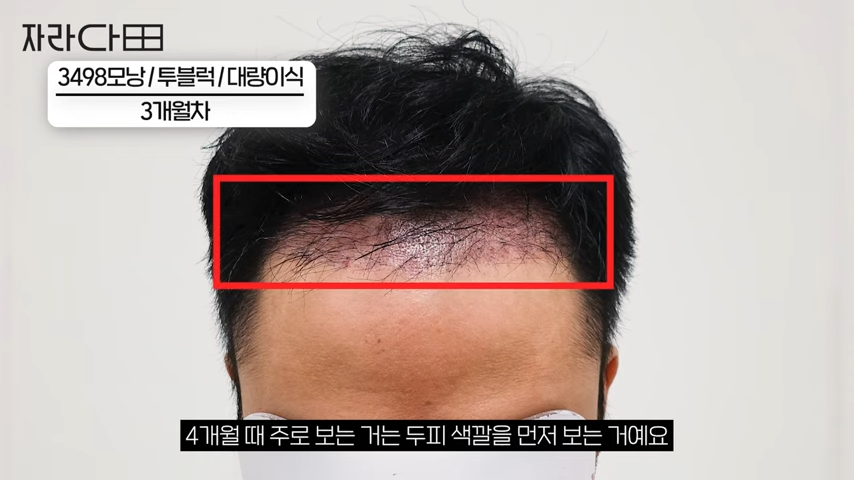 8개월 차 확인
