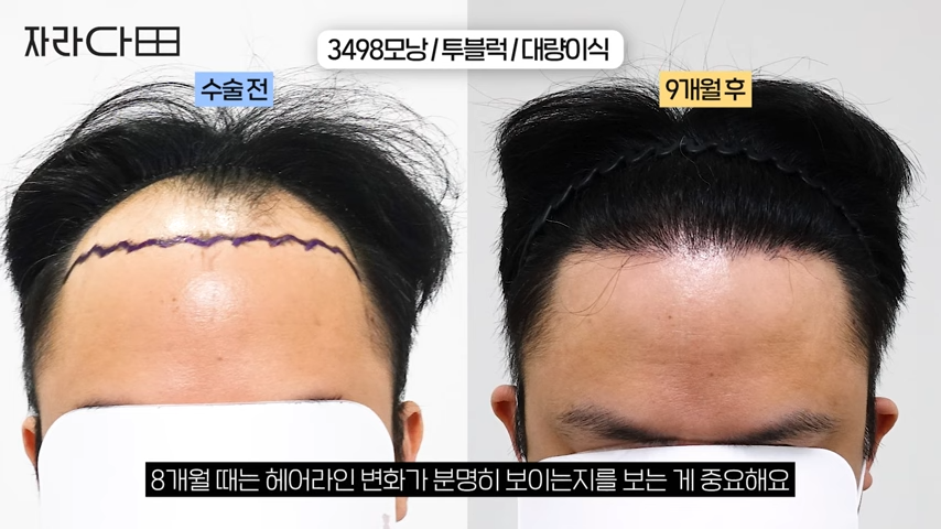 1년 뒤 점검