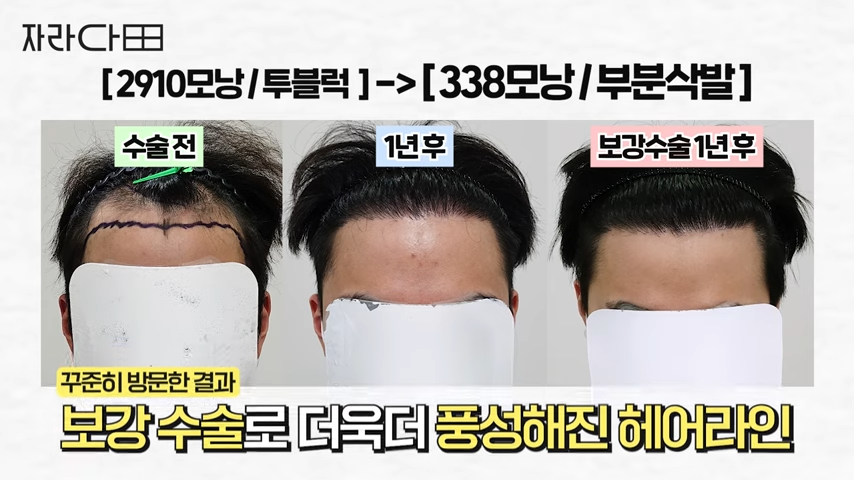 보강 후 결과