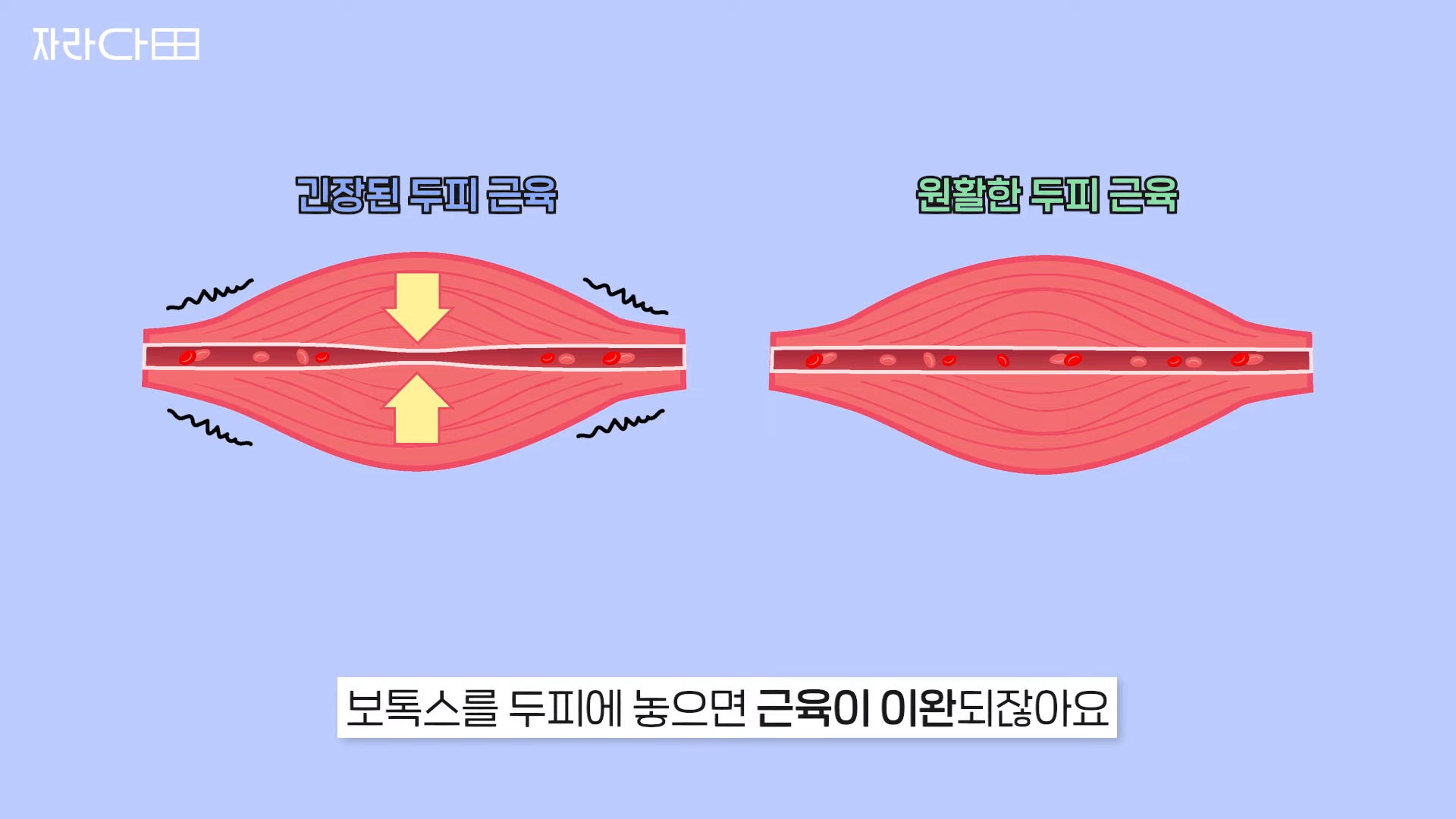 두피 근육 이완과 혈류
