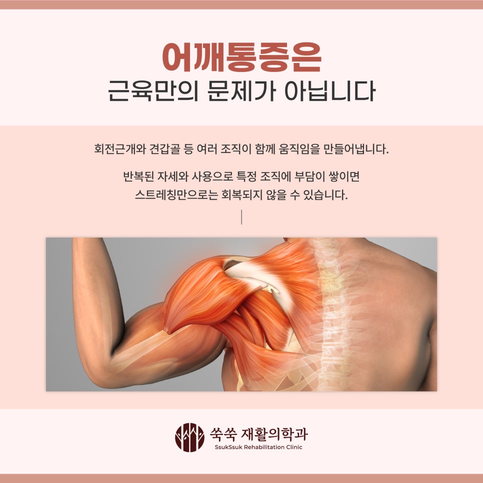 서초역 정형외과 어깨통증, 스트레칭만으로 해결되지 않는 이유가 있습니다