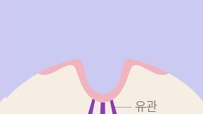 유방 속 유관을 확인합니다.