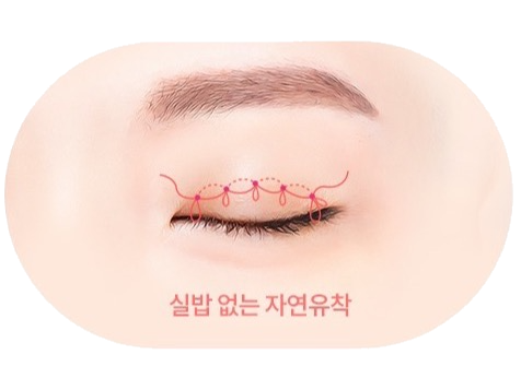 실밥 없는 자연유착