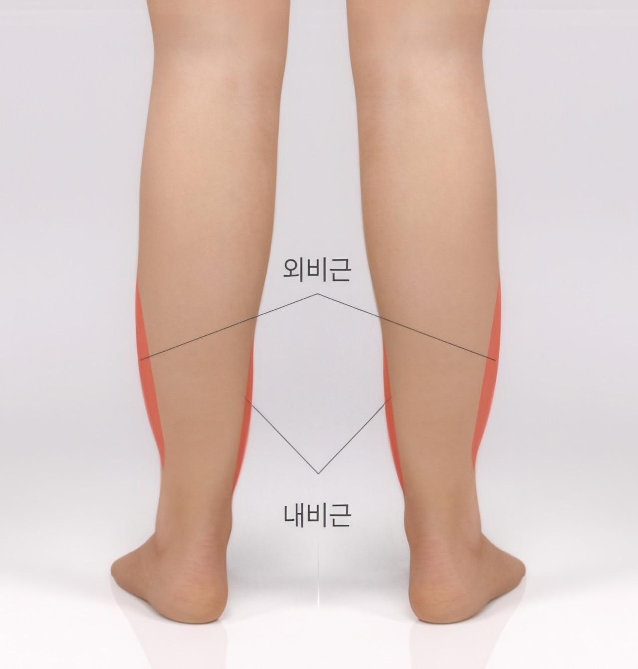 비근(가자미근) 발달형