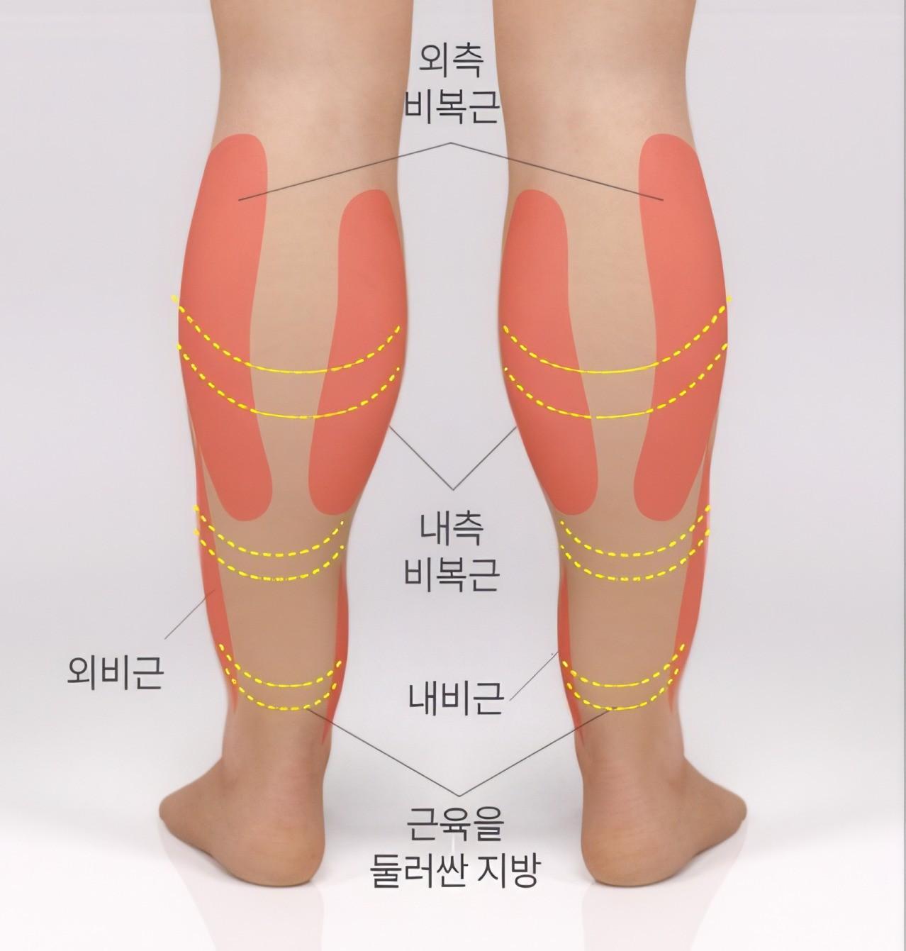 지방+근육 발달형