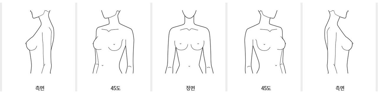 Breast photo examples