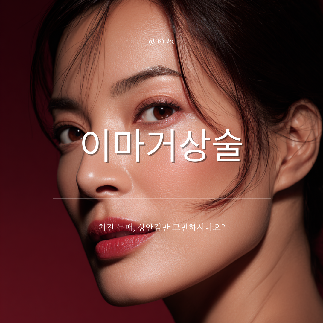 신사역 성형외과 내시경 이마거상술, 상안검과 비교