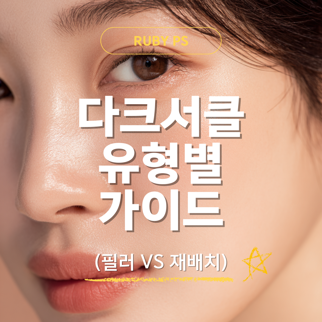 강남 신사역 성형외과 다크서클 유형별 맞춤 시술(필러 또는 재배치)