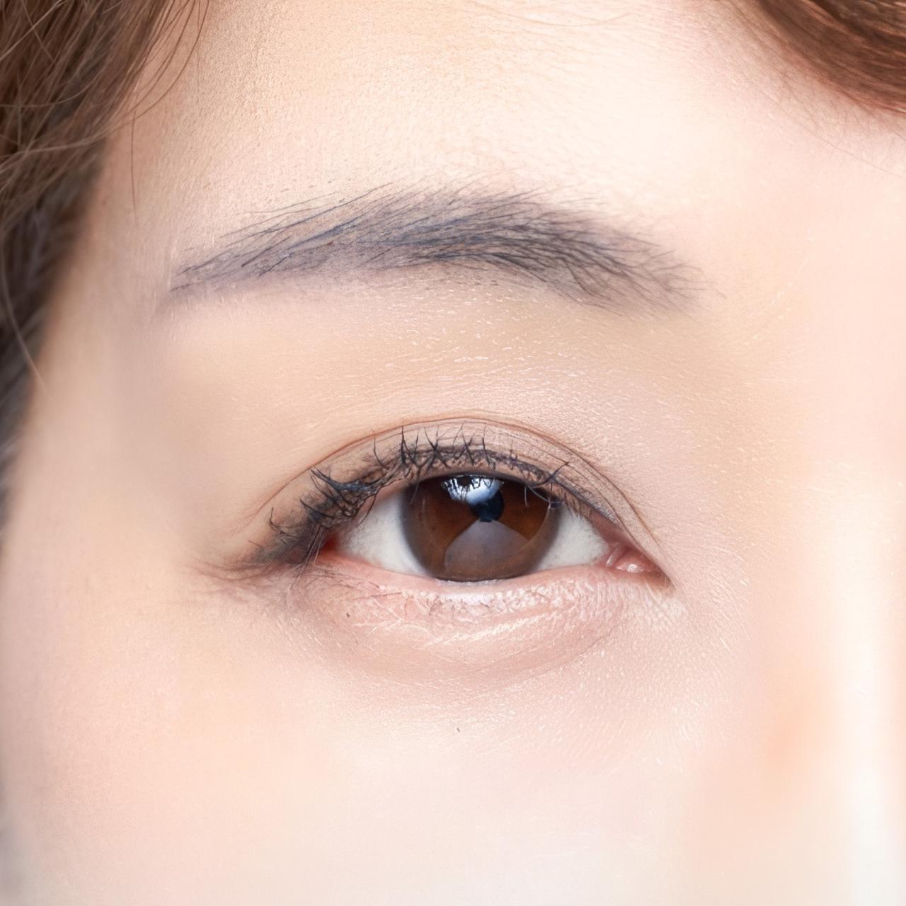 가려진 시야를 시원하게 확보