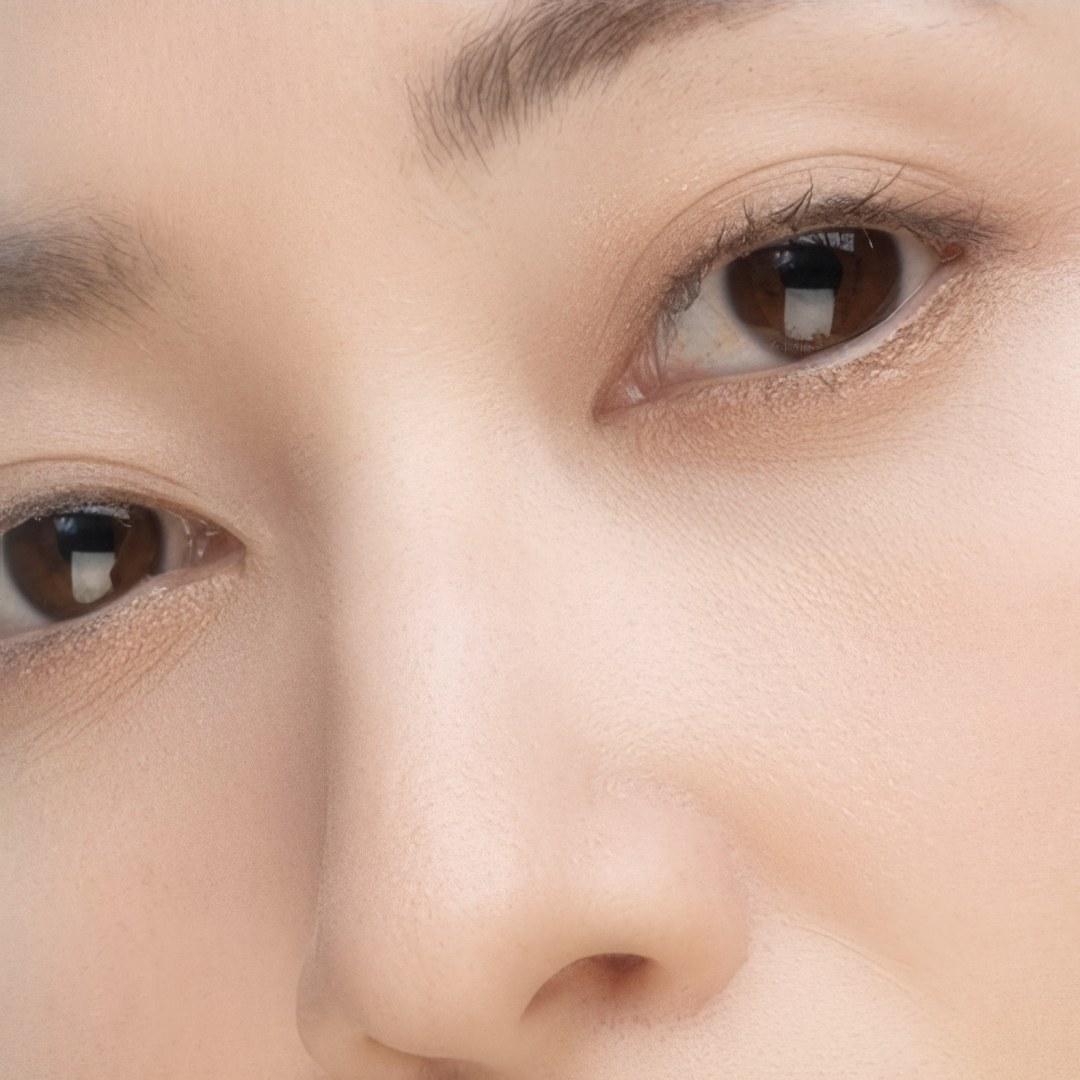 흉터를 최소화한 자연스러운 눈매를 선사합니다.