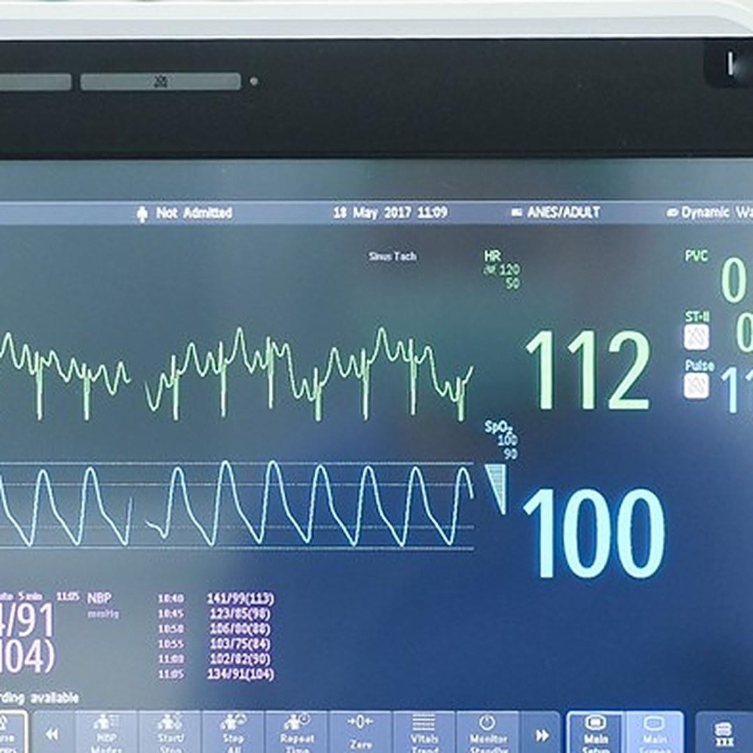 Safe anesthesia and an emergency system