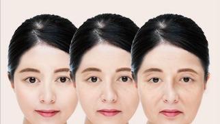 노화도 분석