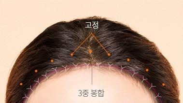 Fixation and suturing