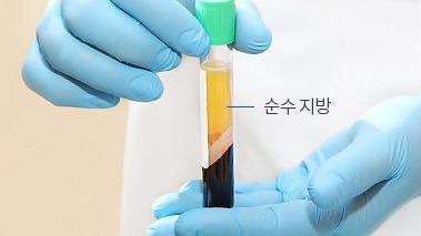 순수 지방만 분리