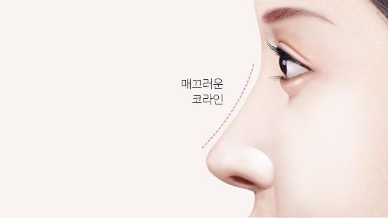 수술 후