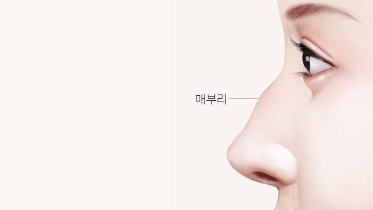 수술 전