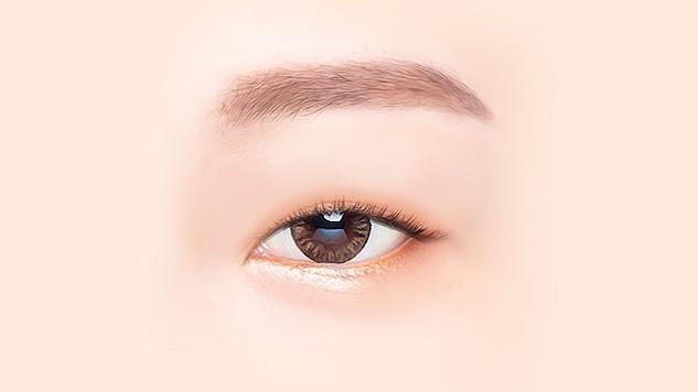 수술 전