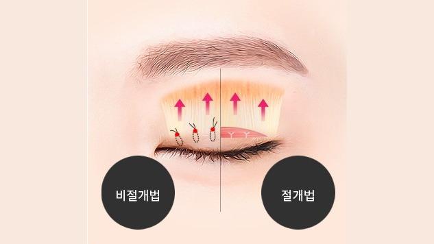 뮬러근 강화 | 올림근 강화