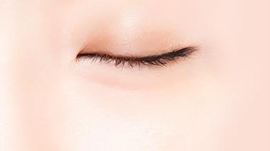 수술 후