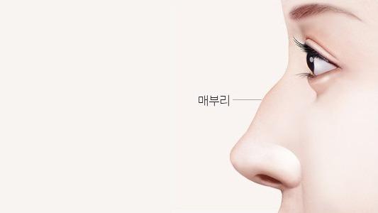 수술 전