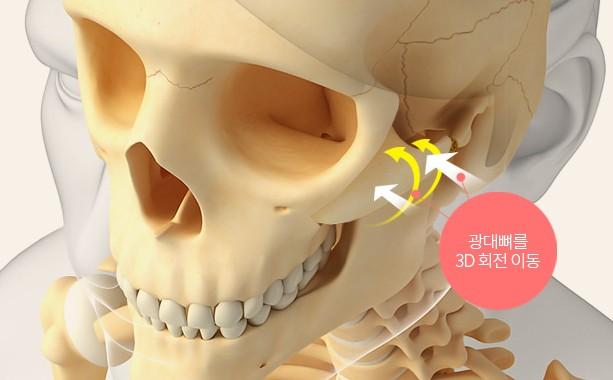 광대뼈를 안쪽으로 3D 회전 이동