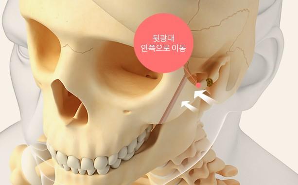 뒷 광대를 꺾어 안쪽으로 회전 이동