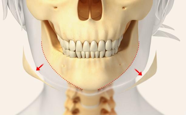 Smooth resection inside the mouth