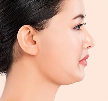 수술 전